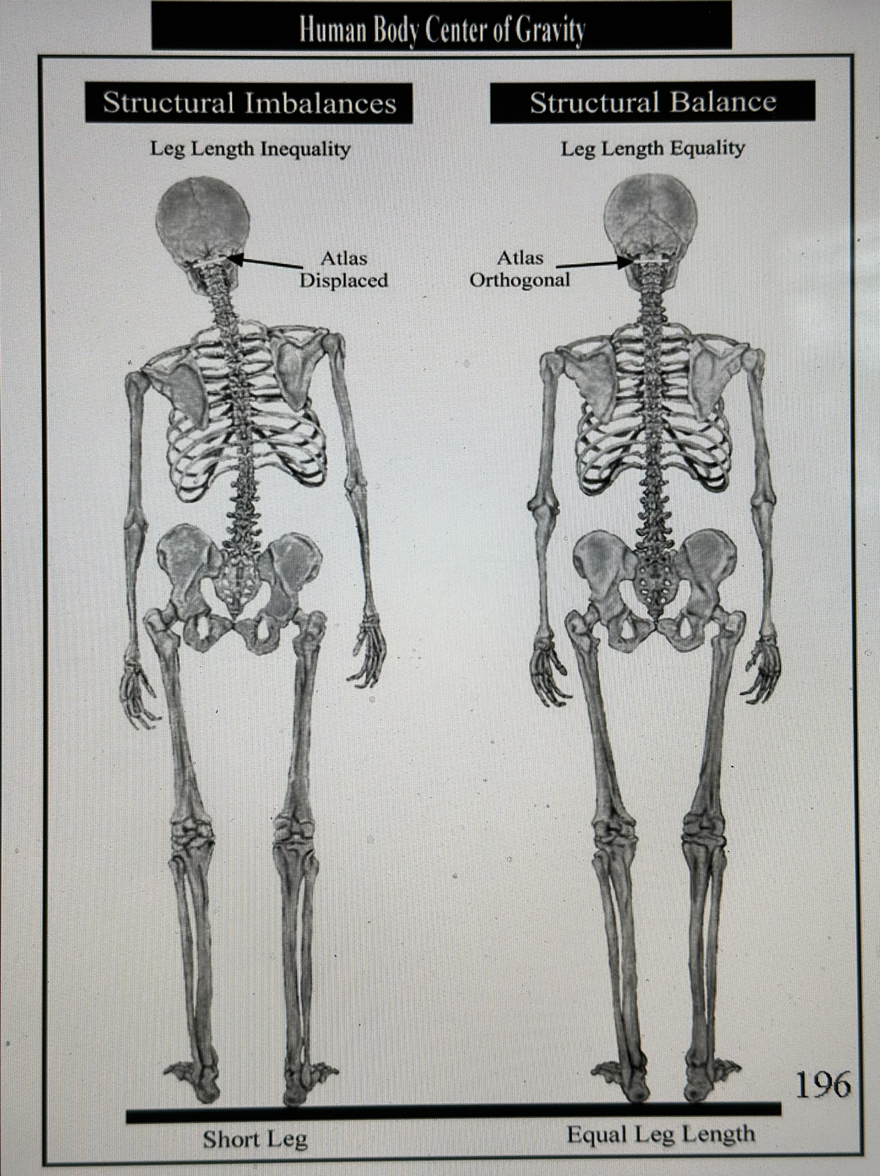 Atlas Orthogonal technique